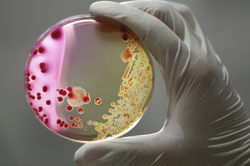 Culture plate with pink bacteria